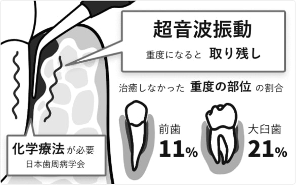 従来の治療法