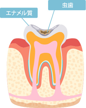 C1の症状