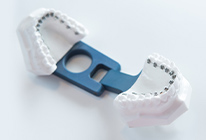 ワイヤー矯正(裏側)