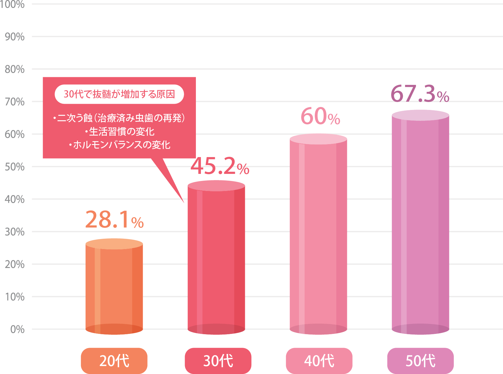 30代で抜髄が増加する原因 ・二次う蝕（治療済み虫歯の再発） ・生活習慣の変化 ・ホルモンバランスの変化