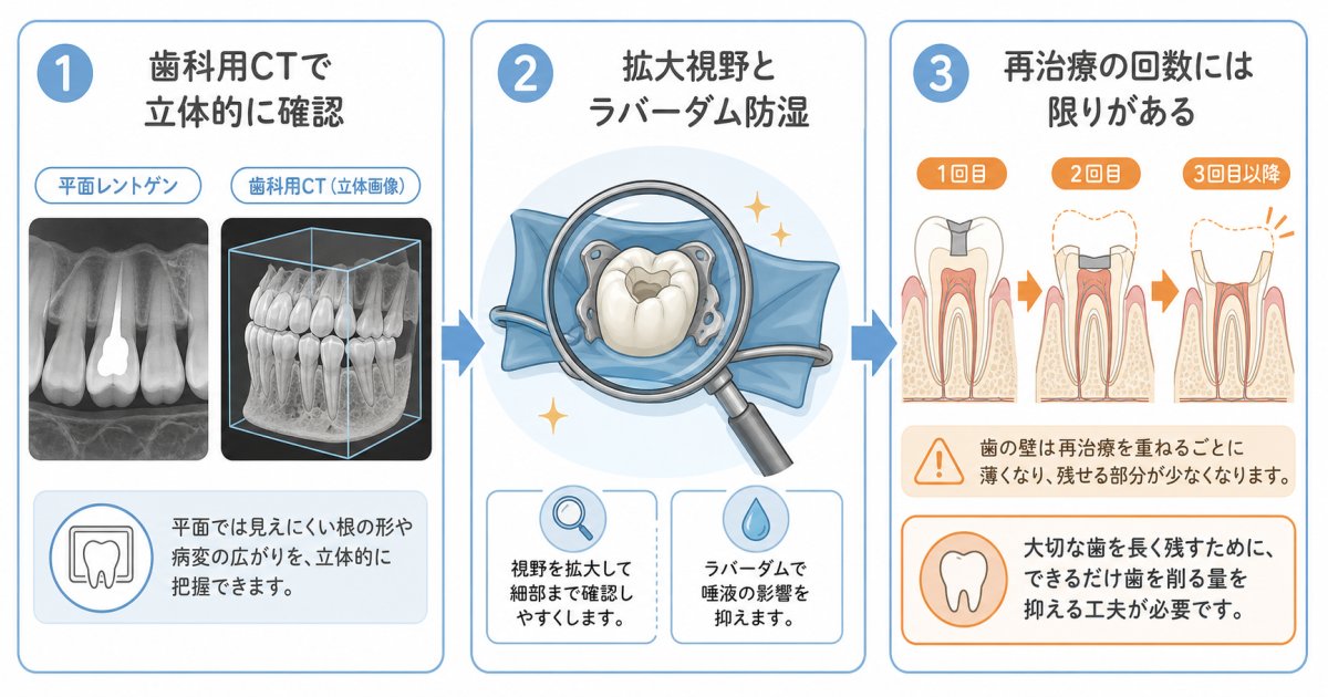 抜歯か根管治療か？歯を残せるかを左右する4つの客観的基準