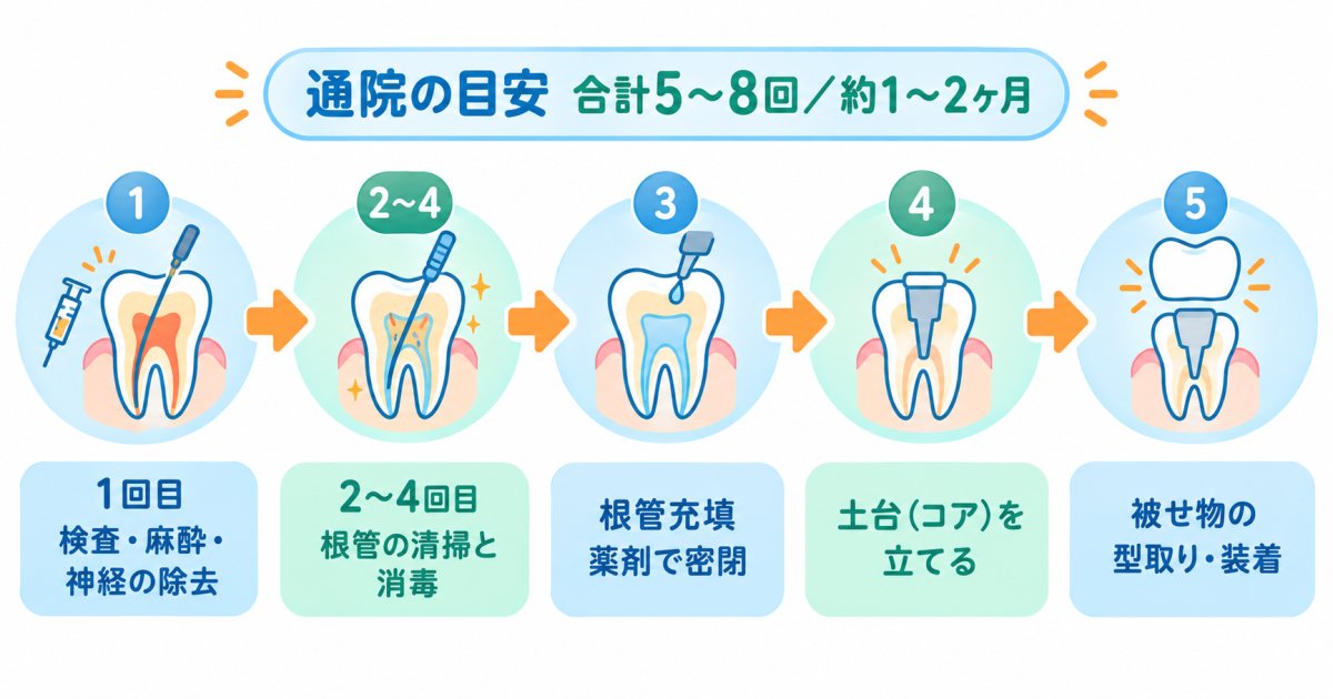 根管治療の流れと通院回数の目安を図で理解する