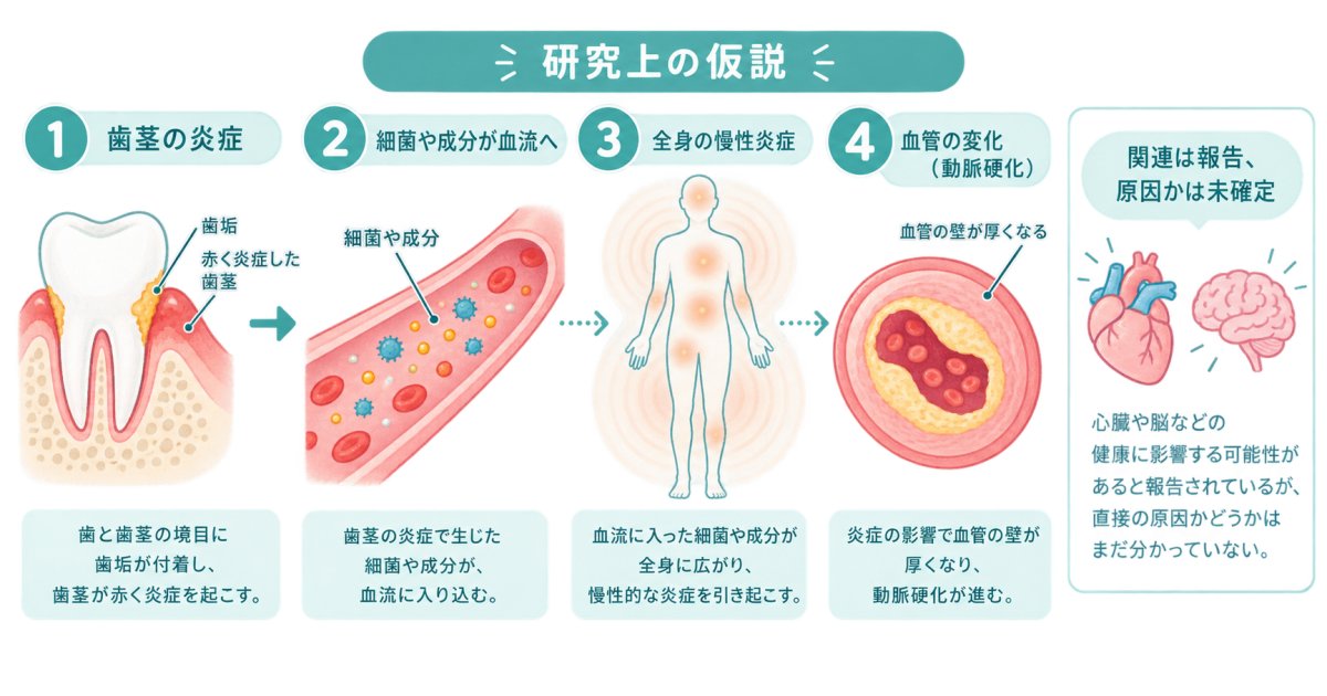 歯周病の炎症は血管にどう関わる？脳の病気との関連