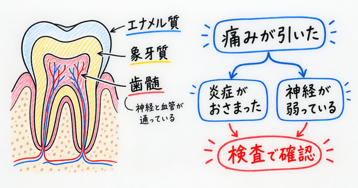 歯の神経にはどんな役割がある?痛みが消えても注意したい理由